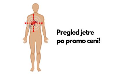 Specijalna ponuda